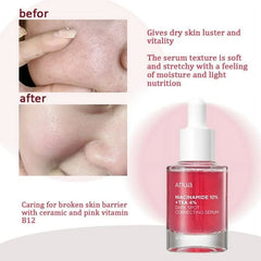 Anua - Niacinamide 10% + TXA 4% Serum [2024 Version - 30ml]